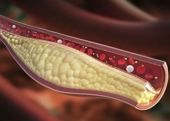 7 mitos sobre el colesterol que probablemente crees