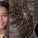 Fallece niña intoxicada tras su padres utilizar insecticida para piojos