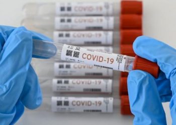 1,158 casos nuevos de COVID-19 en RD