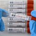 1,158 casos nuevos de COVID-19 en RD