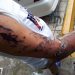 De esta manera quedó el chófer que conducía el vehículo de la joven agredida con ácido del diablo