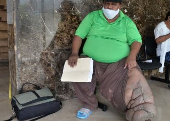 Hombre pide ayuda para operarse una pierna