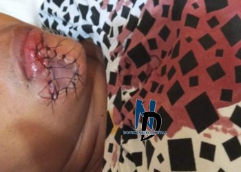 Tres meses de prisión a hombre desprendió labios a una mujer en Montecristi