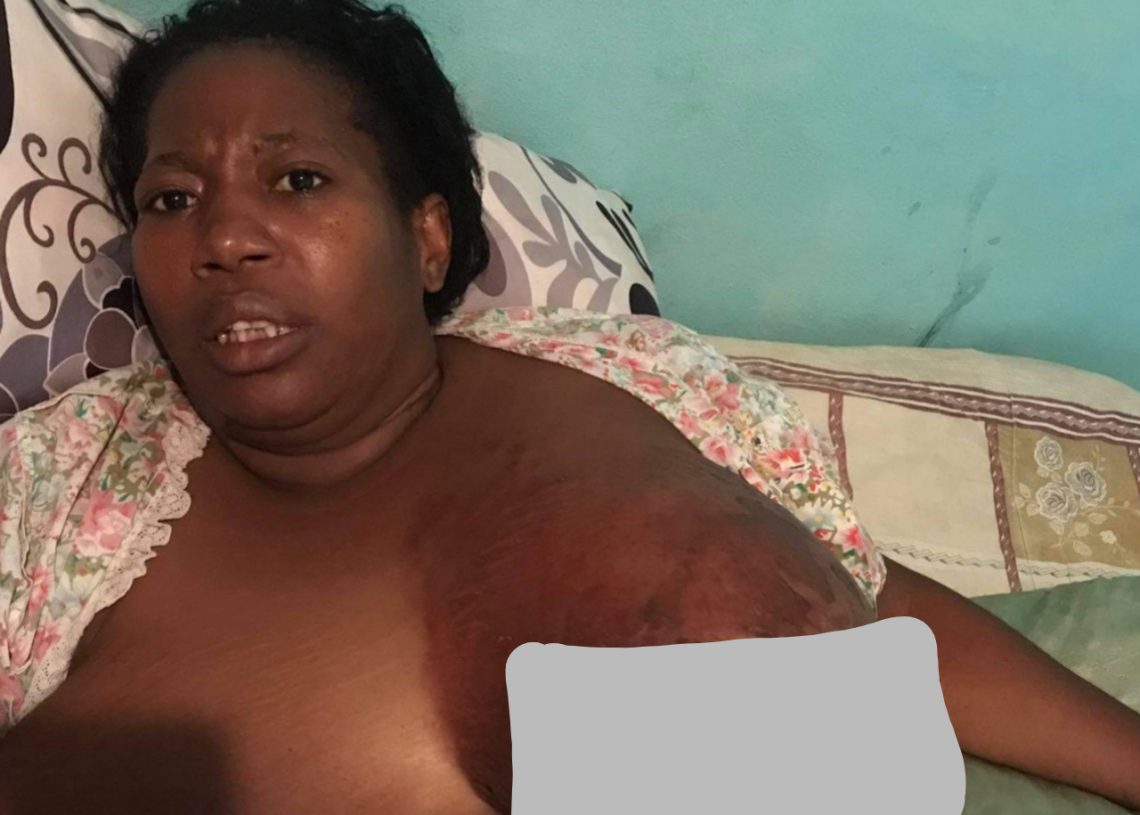 Mujer padece cáncer de mama pide ayuda al Gobierno, empresas o personas caritativas para tratarse letal enfermedad