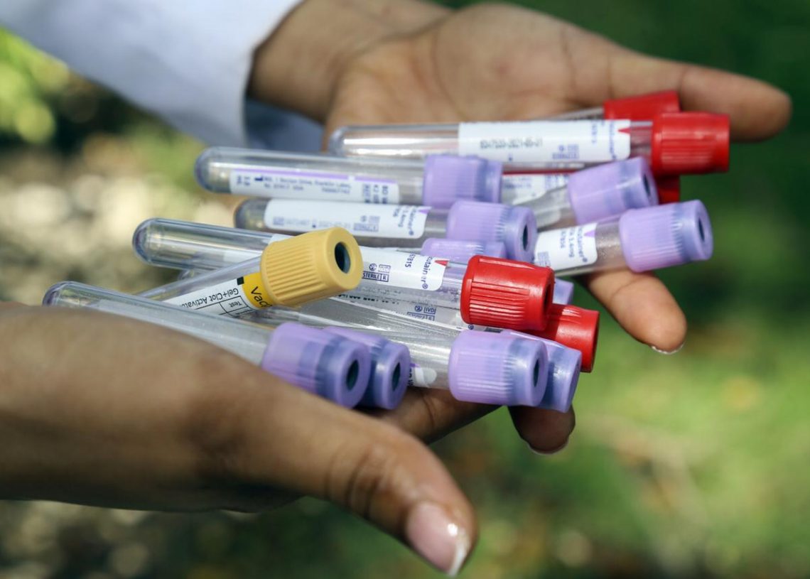 Centro de Control de Enfermedades de Atlanta recibirá muestras del país para identificar nuevas cepas del SARS-COV-2