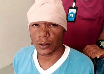 «Salió vivo de chepa» Extraen clavo que hombre se incrustó en la cabeza porque sentía su “cerebro flojo”