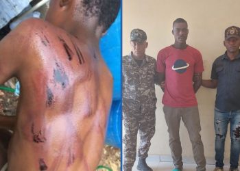 Policía arresta hombre dio golpiza a su hijo menor