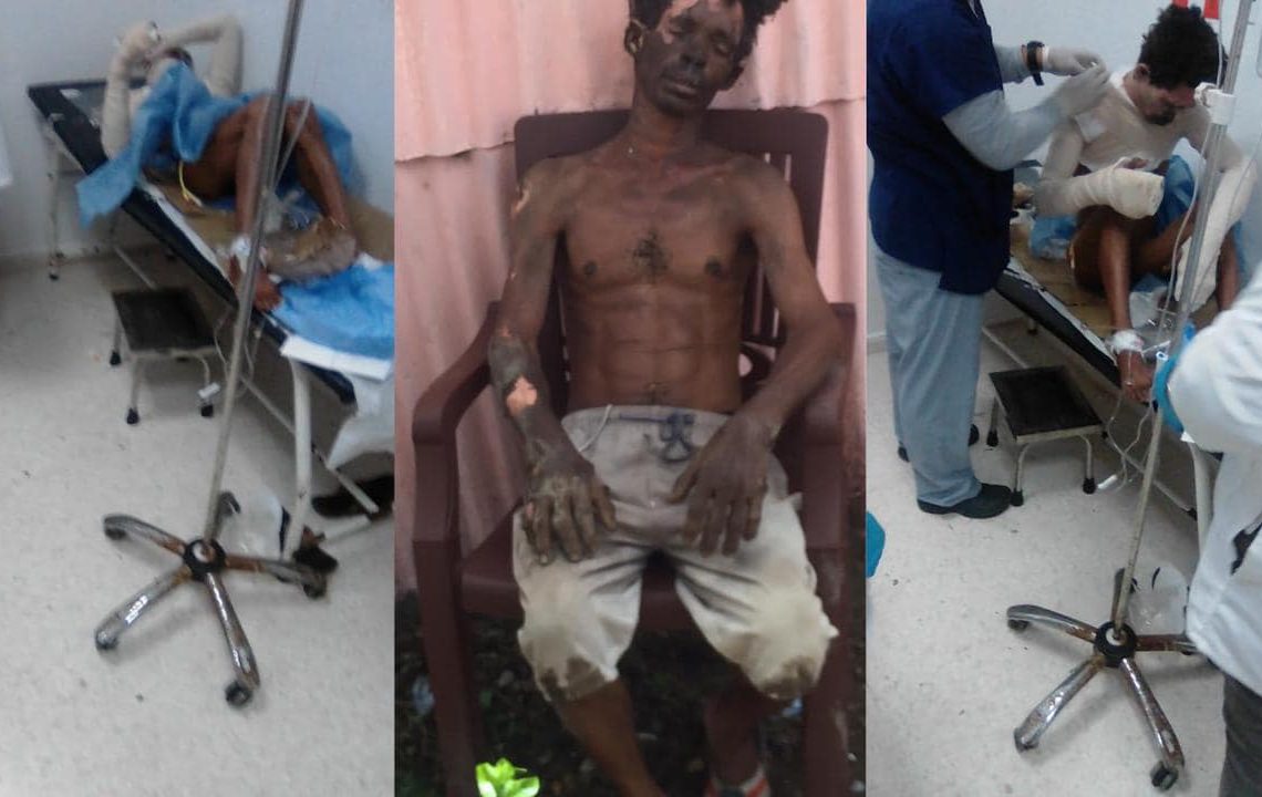 Mujer resulta afectada tras lanzarle agua hirviendo a su esposo por supuestos asuntos pasionales