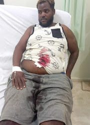 En Villa Vásquez balean hombre por la espalda mientras se desplaza en motocicleta