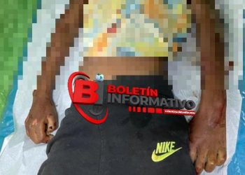 Muere Niño de 5 años atropellado por una camioneta – Suman 4 los fallecidos semana santa Montecristi
