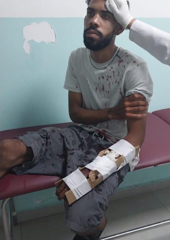 Apresan a tres presuntos integrantes de bandas juveniles en Santiago Rodríguez