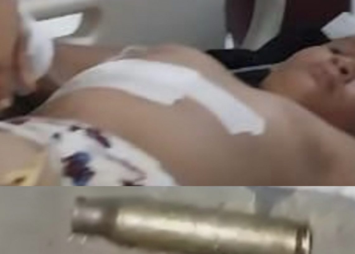 Niño de 8 años resultó herido tras tiroteo en Montecristi- Ya está fuera de peligro