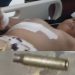 Niño de 8 años resultó herido tras tiroteo en Montecristi- Ya está fuera de peligro
