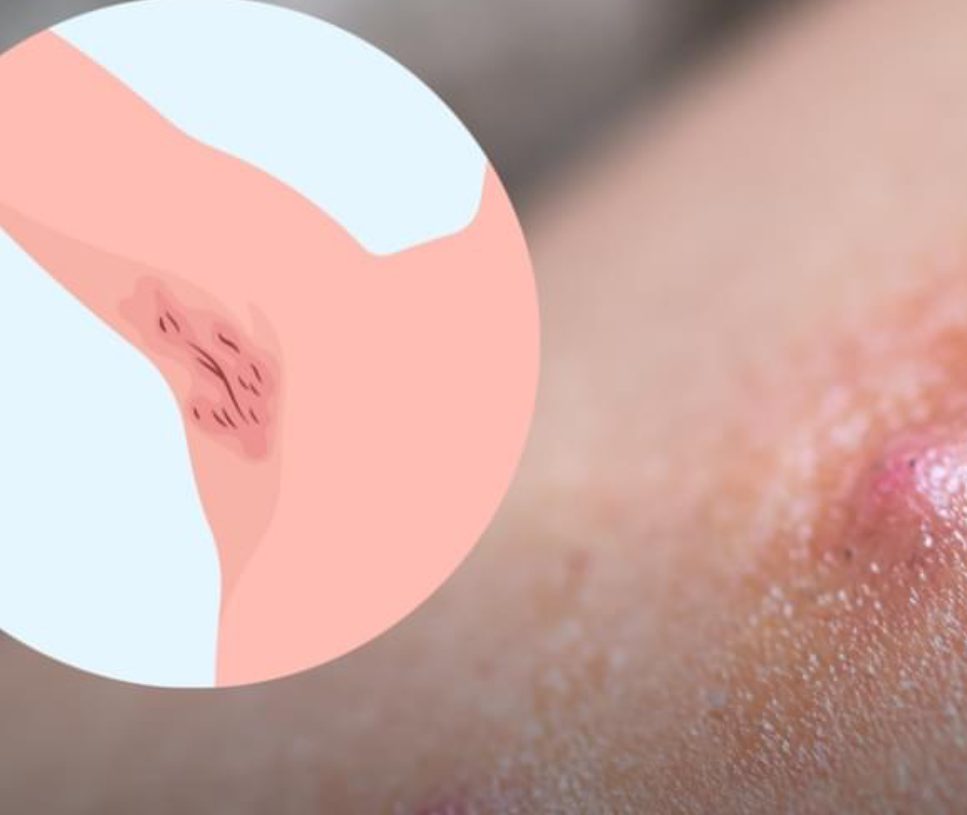 Lo que debes saber de los molestos golondrinos